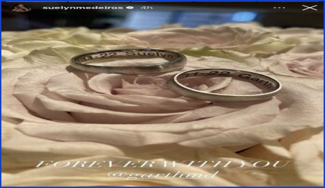 Instagram Model Suleyn Medeiros MARRIES The Surgeon Who Gave Her A BBL!! (PICS)